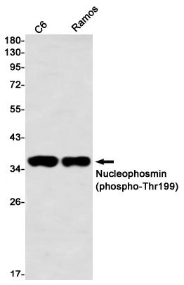 Phospho-Nucleophosmin (Thr199) Rabbit mAb