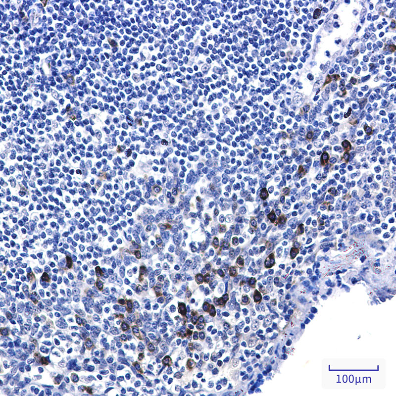 Phospho-p53 (Ser6) Rabbit mAb