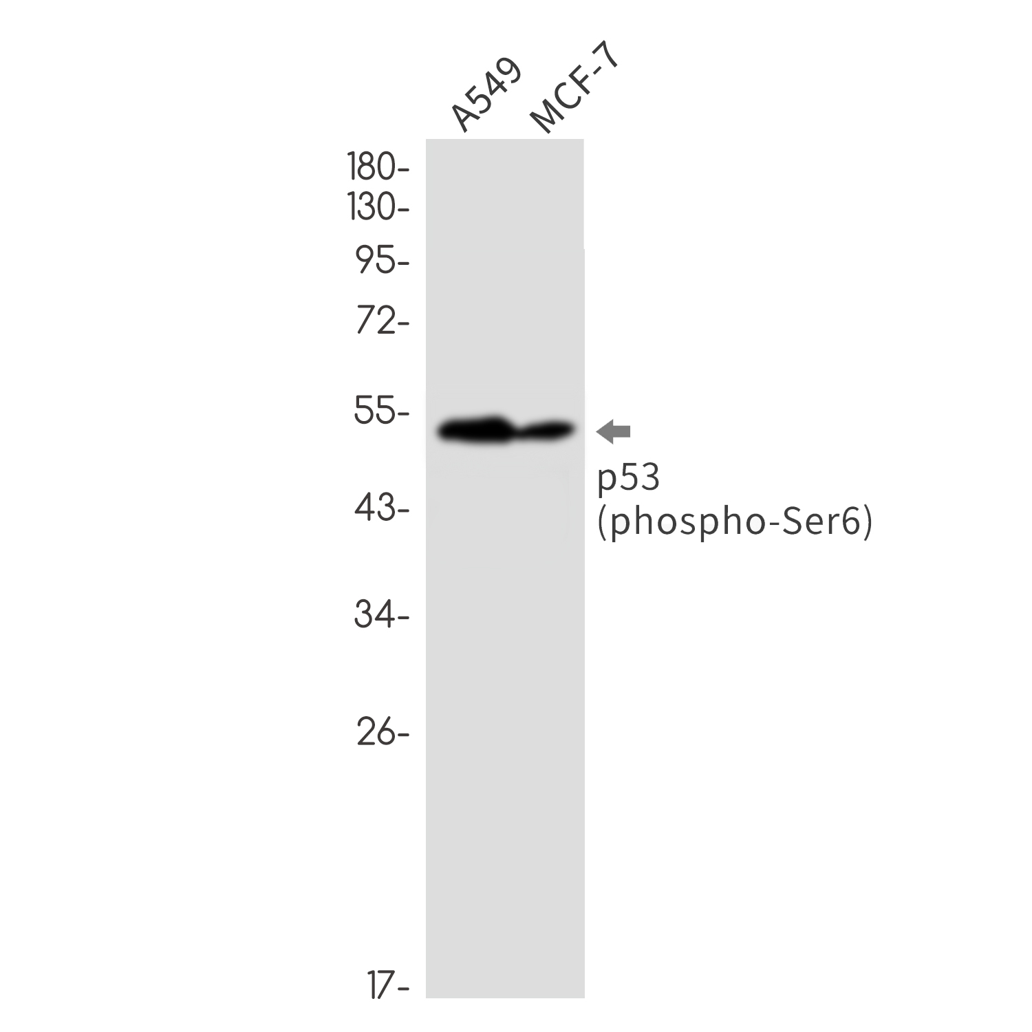 Phospho-p53 (Ser6) Rabbit mAb