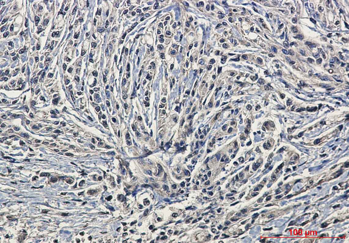 Phospho-PKC alpha (Ser657) Rabbit mAb