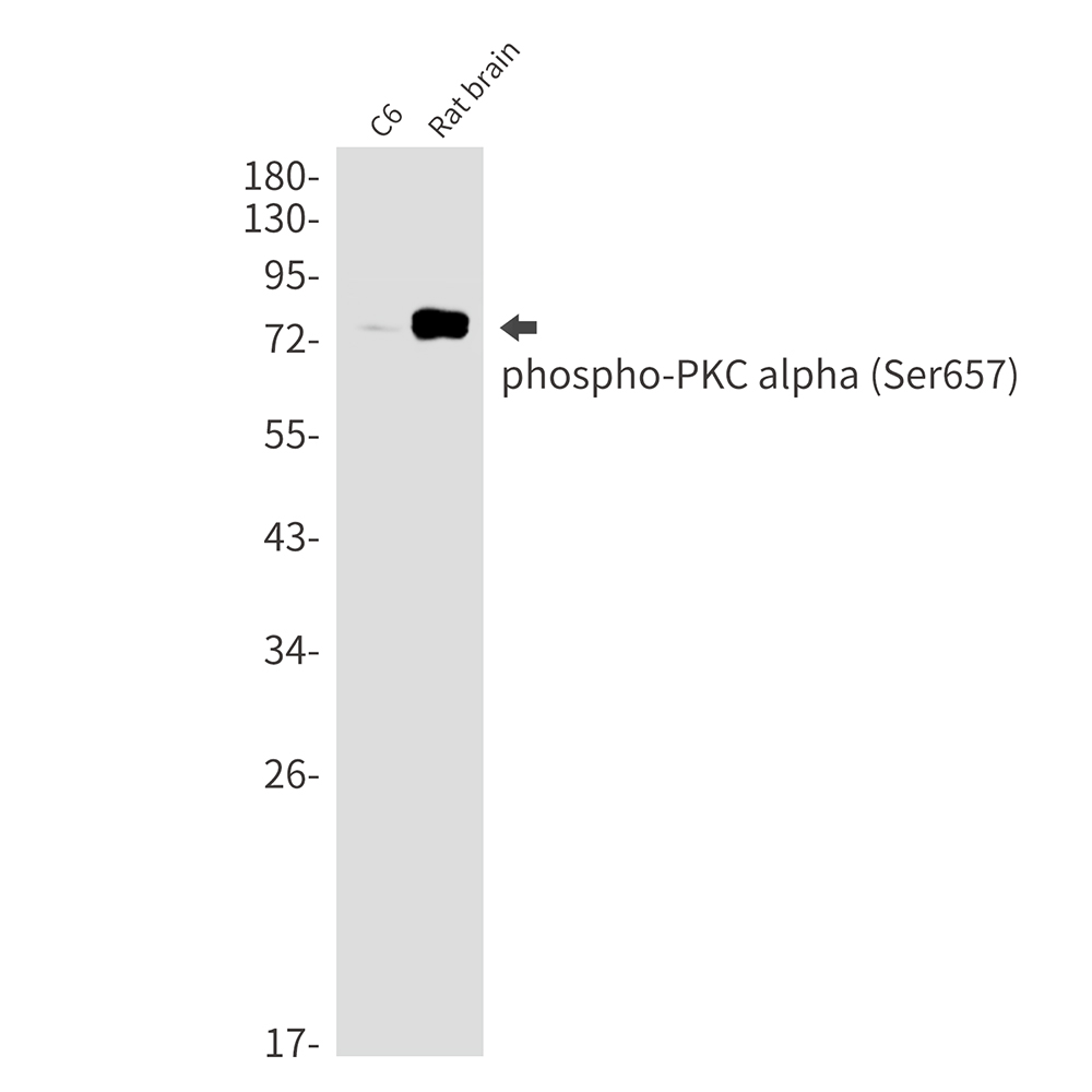 Phospho-PKC alpha (Ser657) Rabbit mAb