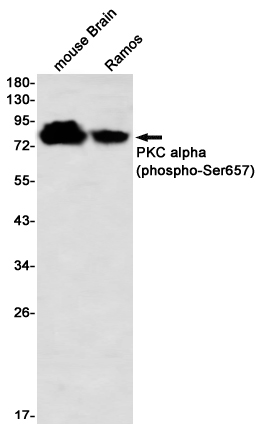 Phospho-PKC alpha (Ser657) Rabbit mAb