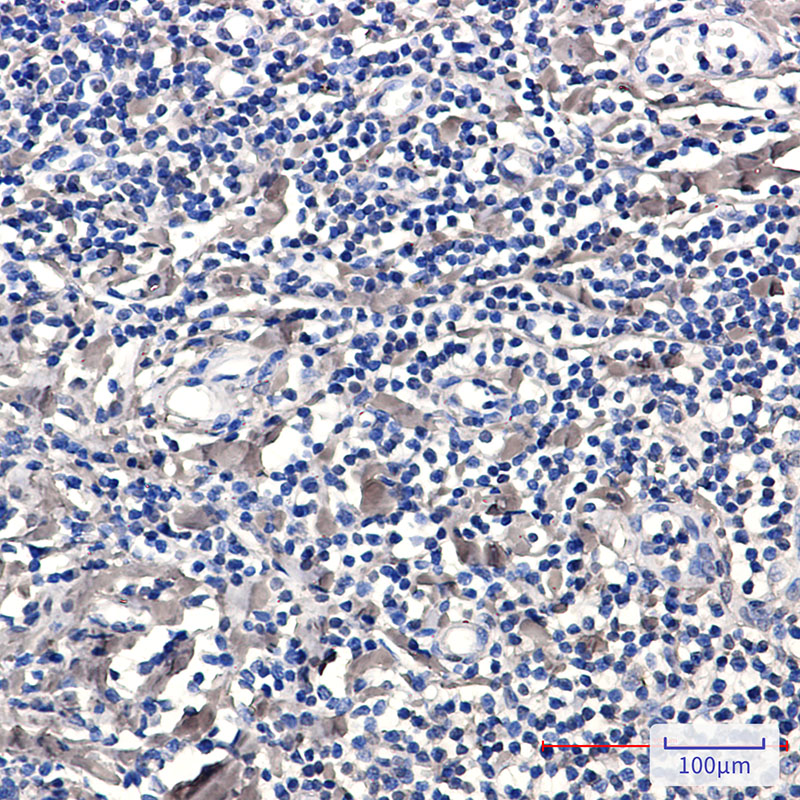 Phospho-PKC delta (Ser299) Rabbit mAb