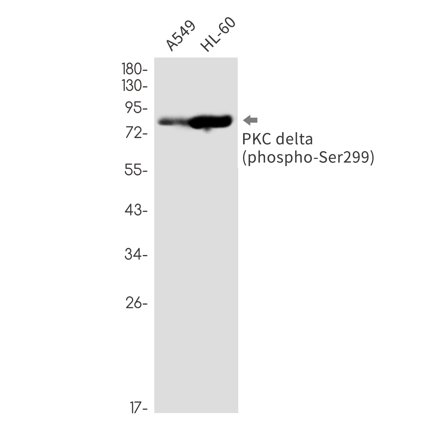 Phospho-PKC delta (Ser299) Rabbit mAb