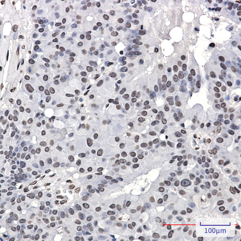 Phospho-PML Protein (Ser518) Rabbit mAb