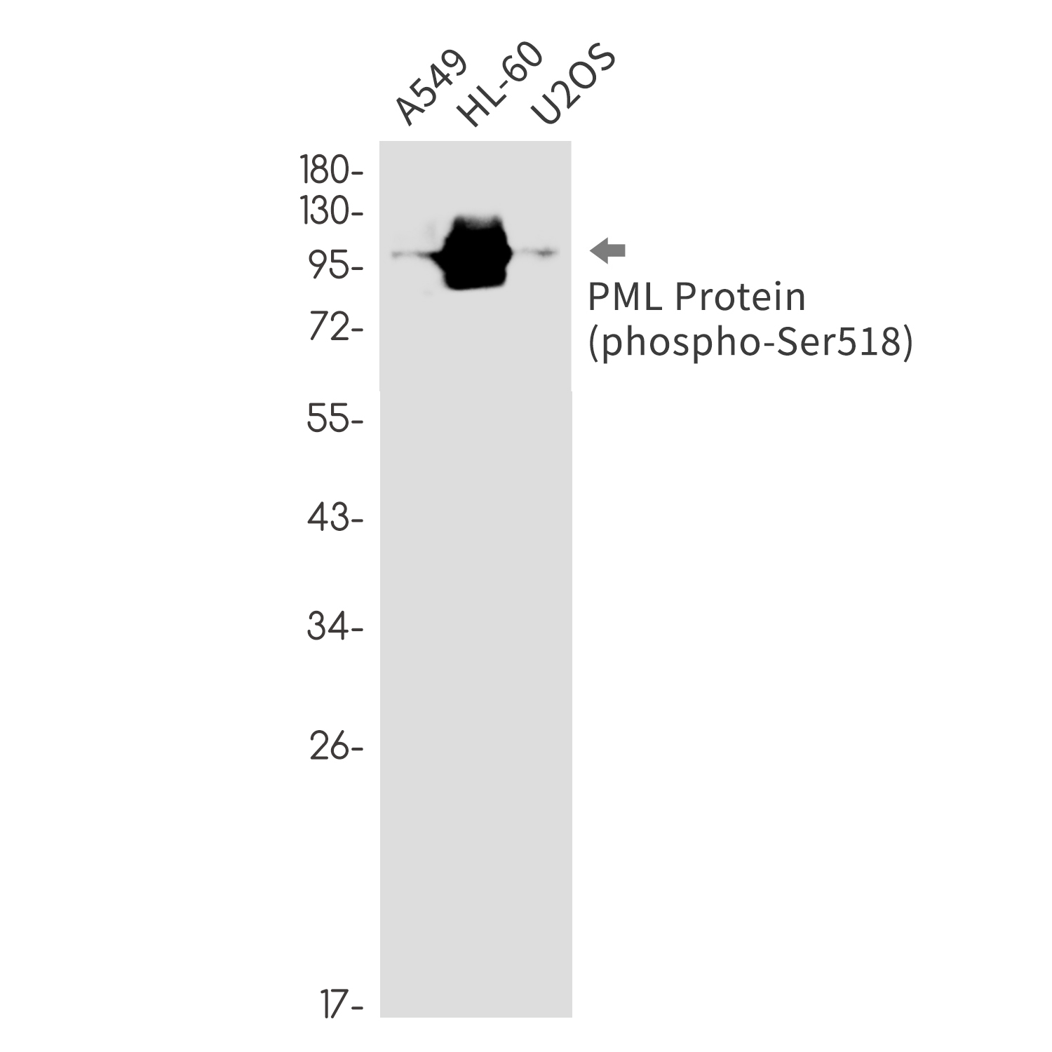 Phospho-PML Protein (Ser518) Rabbit mAb