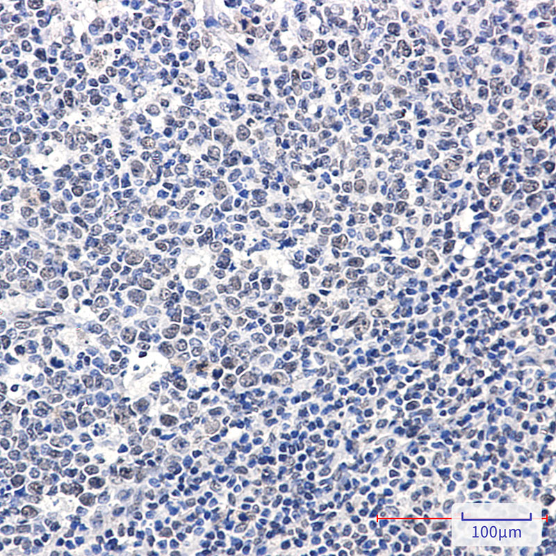 Phospho-Rb (Ser608) Rabbit mAb