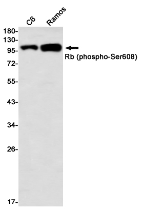 Phospho-Rb (Ser608) Rabbit mAb