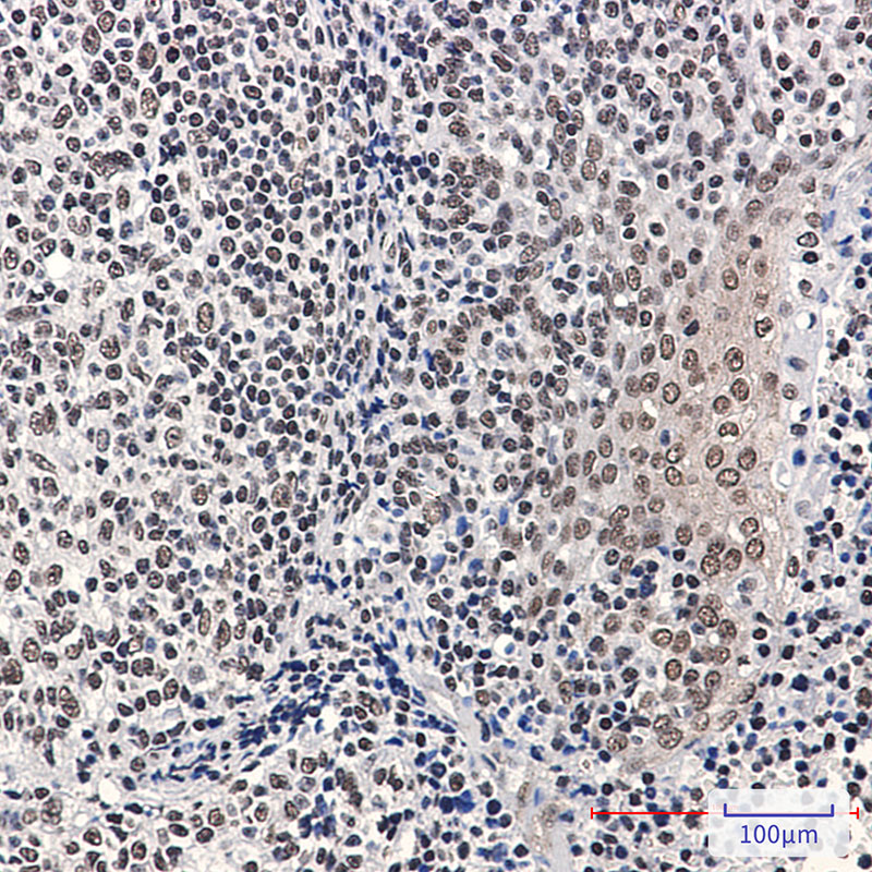 Phospho-Rb (Ser780) Rabbit mAb