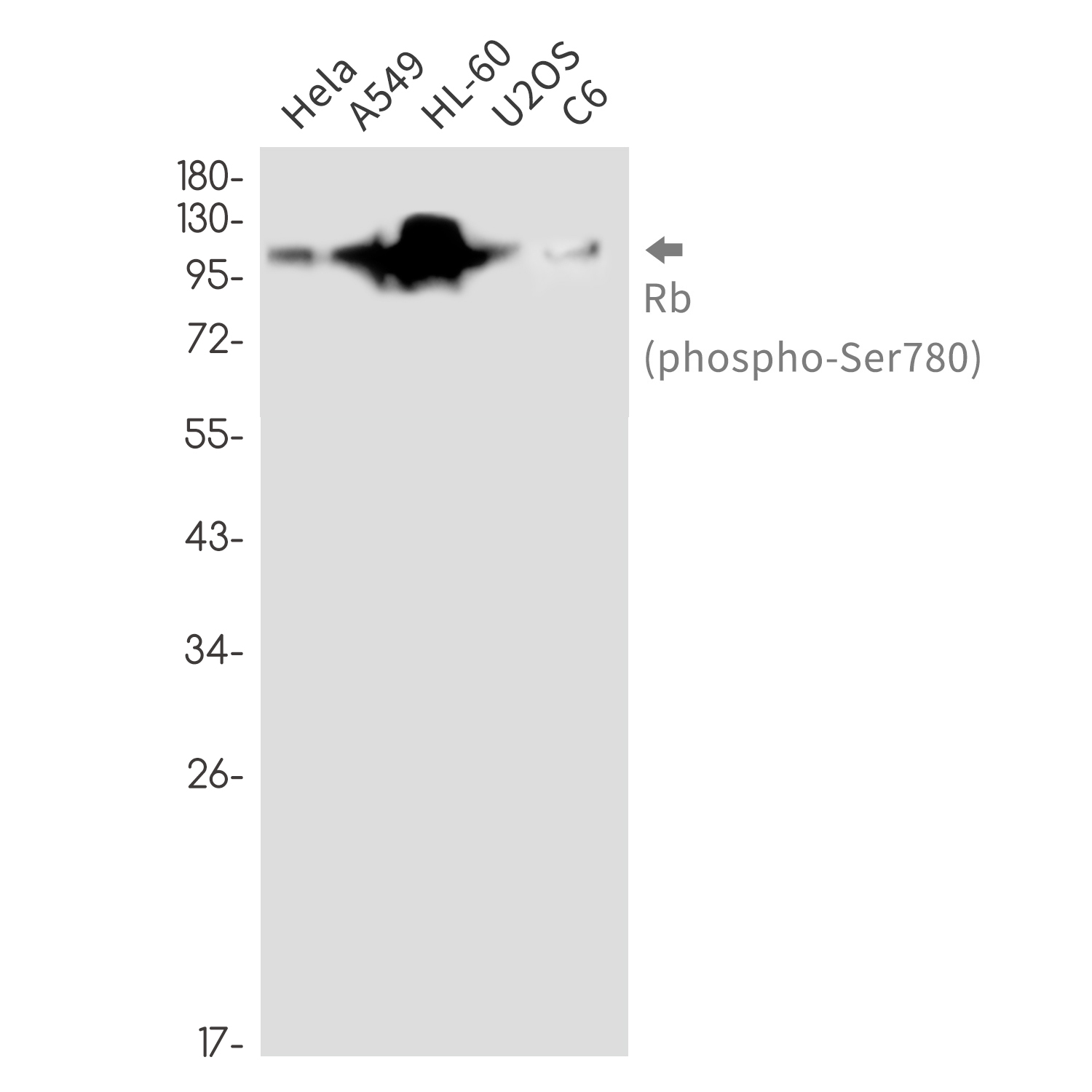 Phospho-Rb (Ser780) Rabbit mAb