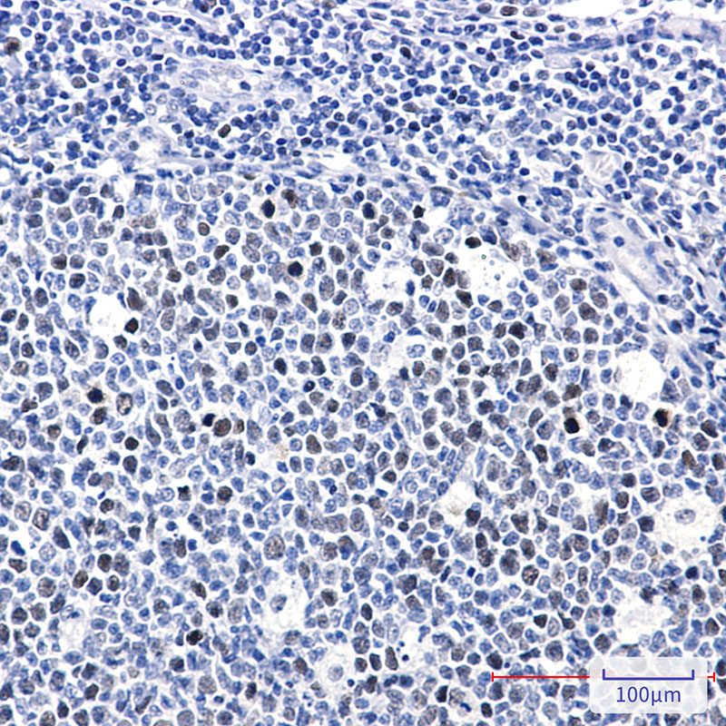 Phospho-Rb (Thr252) Rabbit mAb