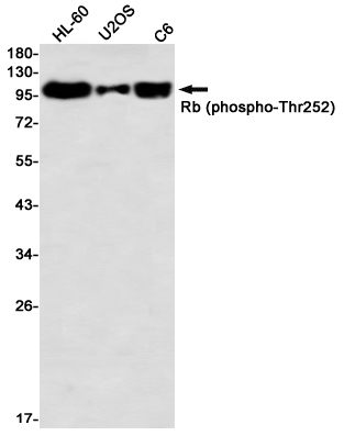 Phospho-Rb (Thr252) Rabbit mAb