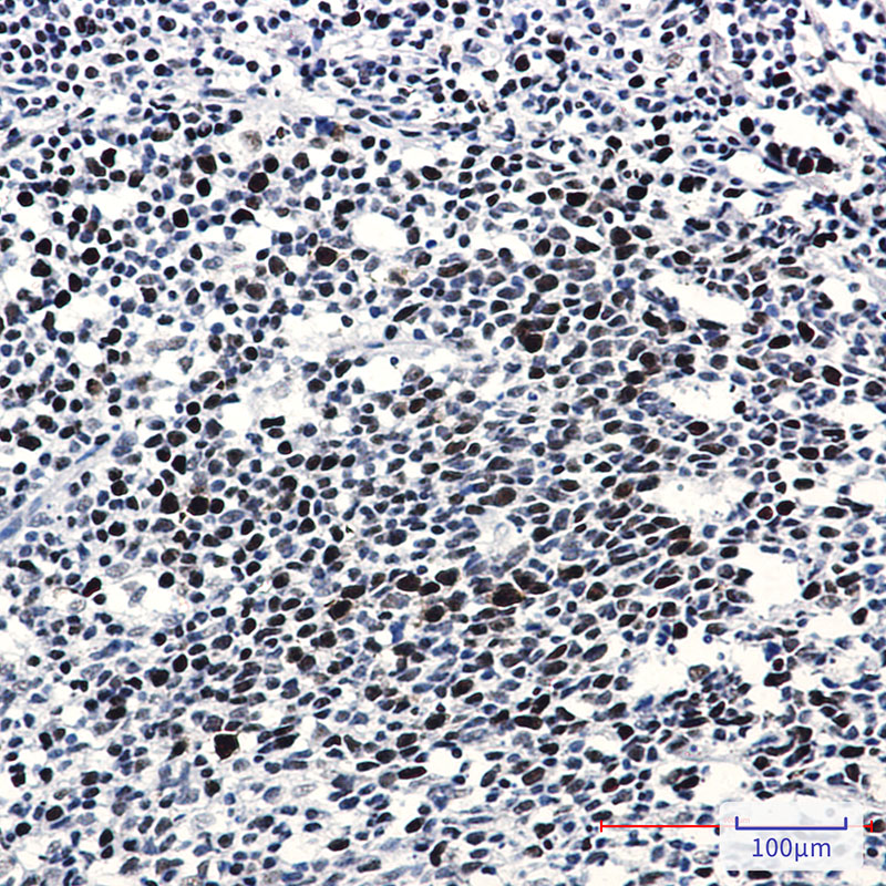 Phospho-Rb (Thr356) Rabbit mAb