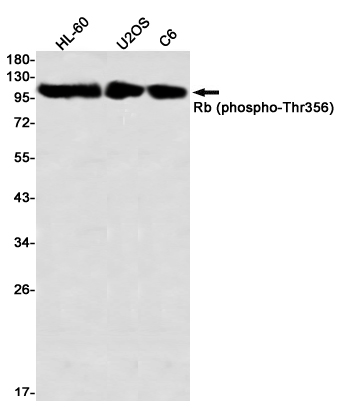 Phospho-Rb (Thr356) Rabbit mAb