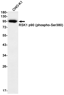 Phospho-RSK1 p90 (Ser380) Rabbit mAb