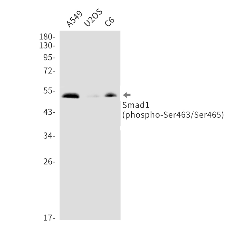 Phospho-Smad1 (Ser463/Ser465) Rabbit mAb