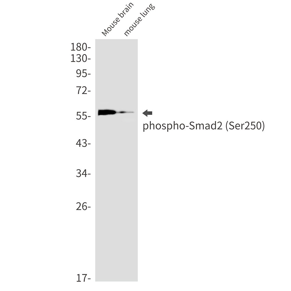 Phospho-Smad2 (Ser250) Rabbit mAb