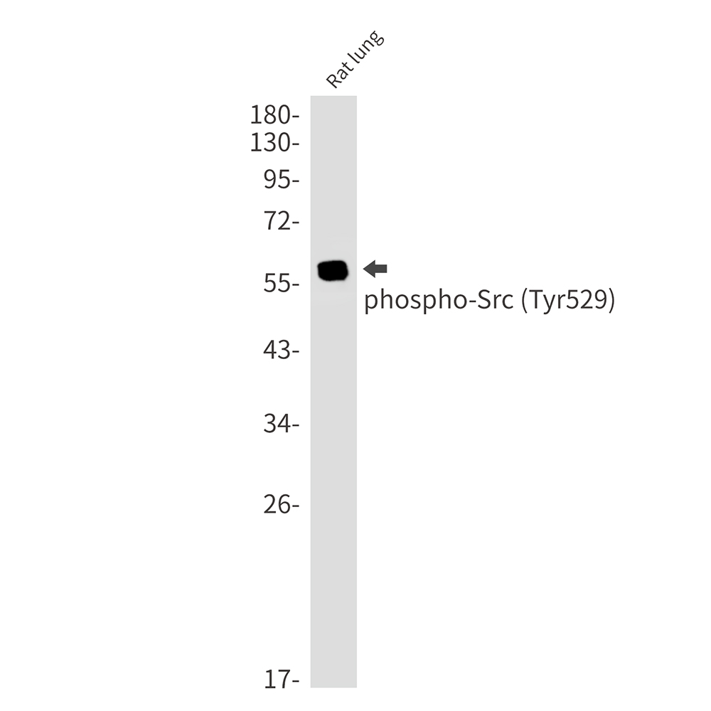 Phospho-Src (Tyr530) Rabbit mAb