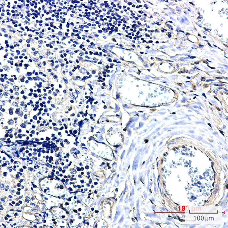 14-3-3 alpha/beta Rabbit mAb