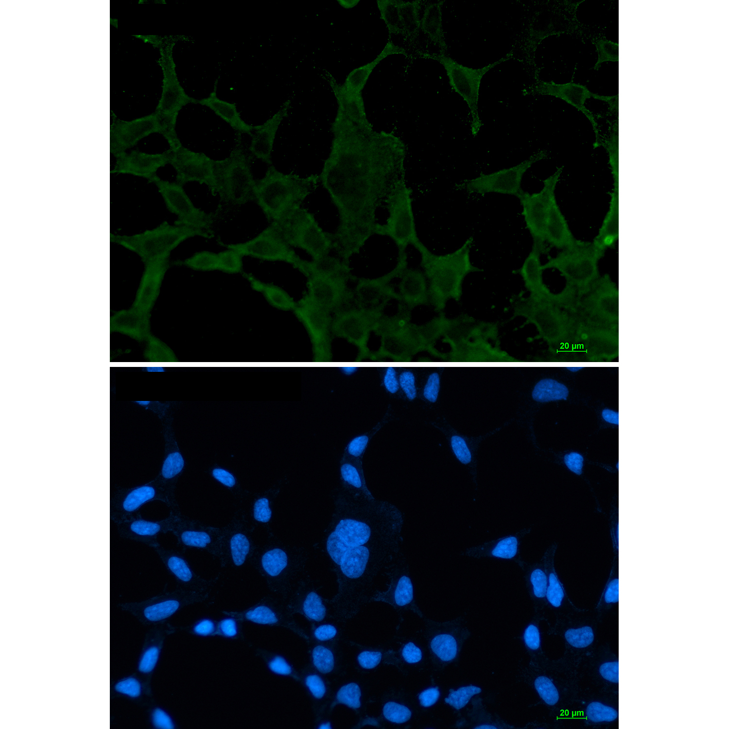 ACADM Rabbit mAb