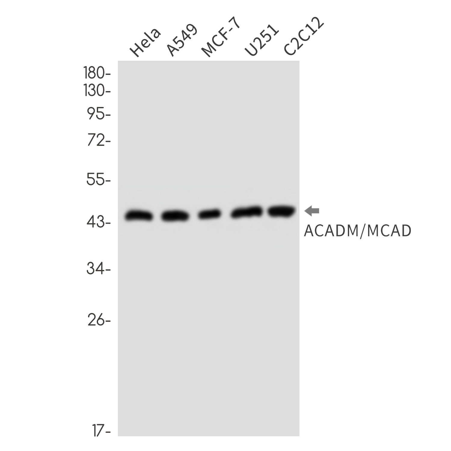 ACADM Rabbit mAb