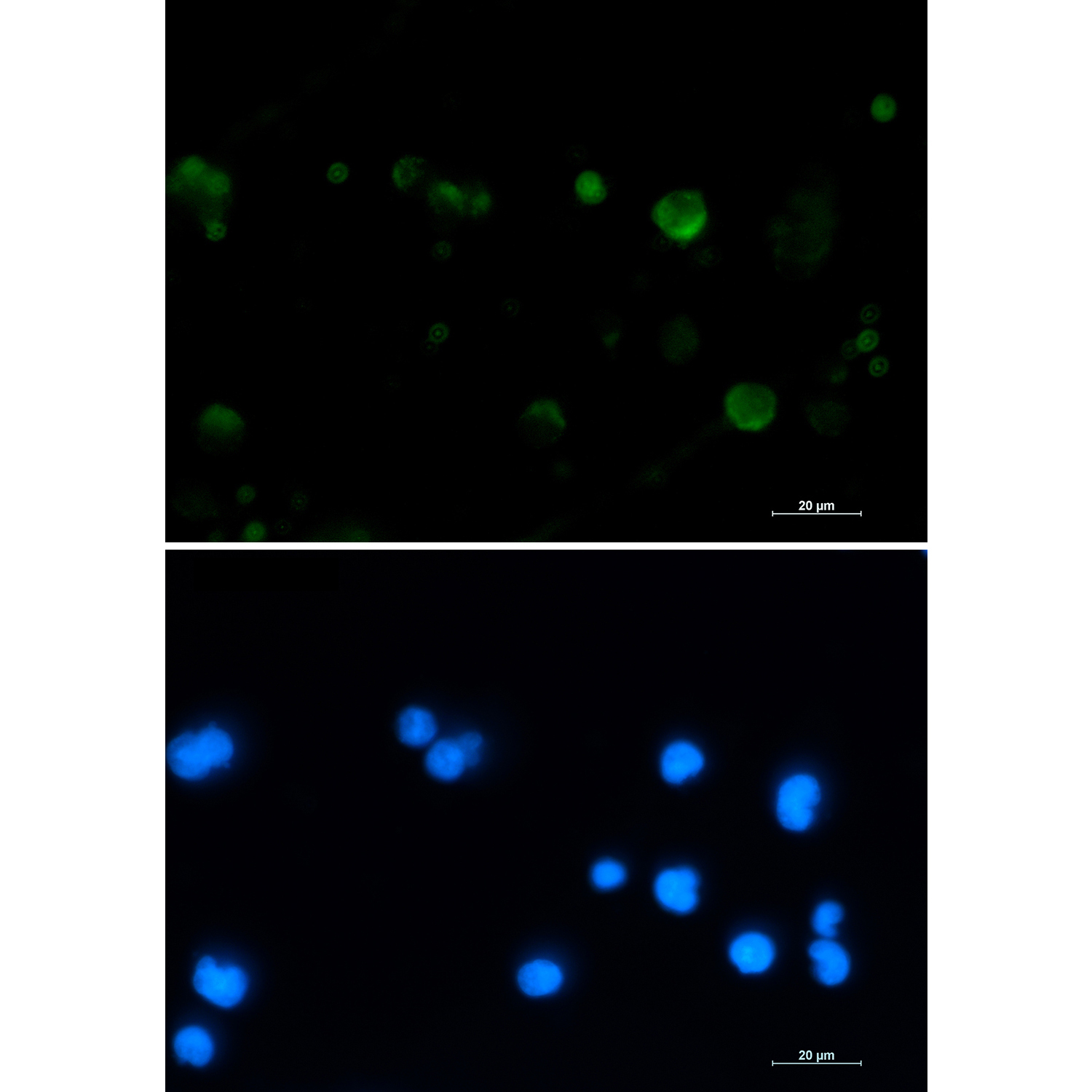 Aconitase 2 Rabbit mAb