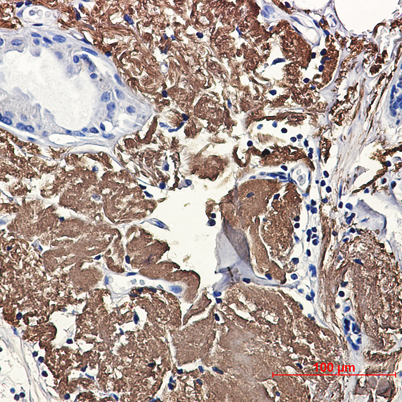 Aconitase 2 Rabbit mAb