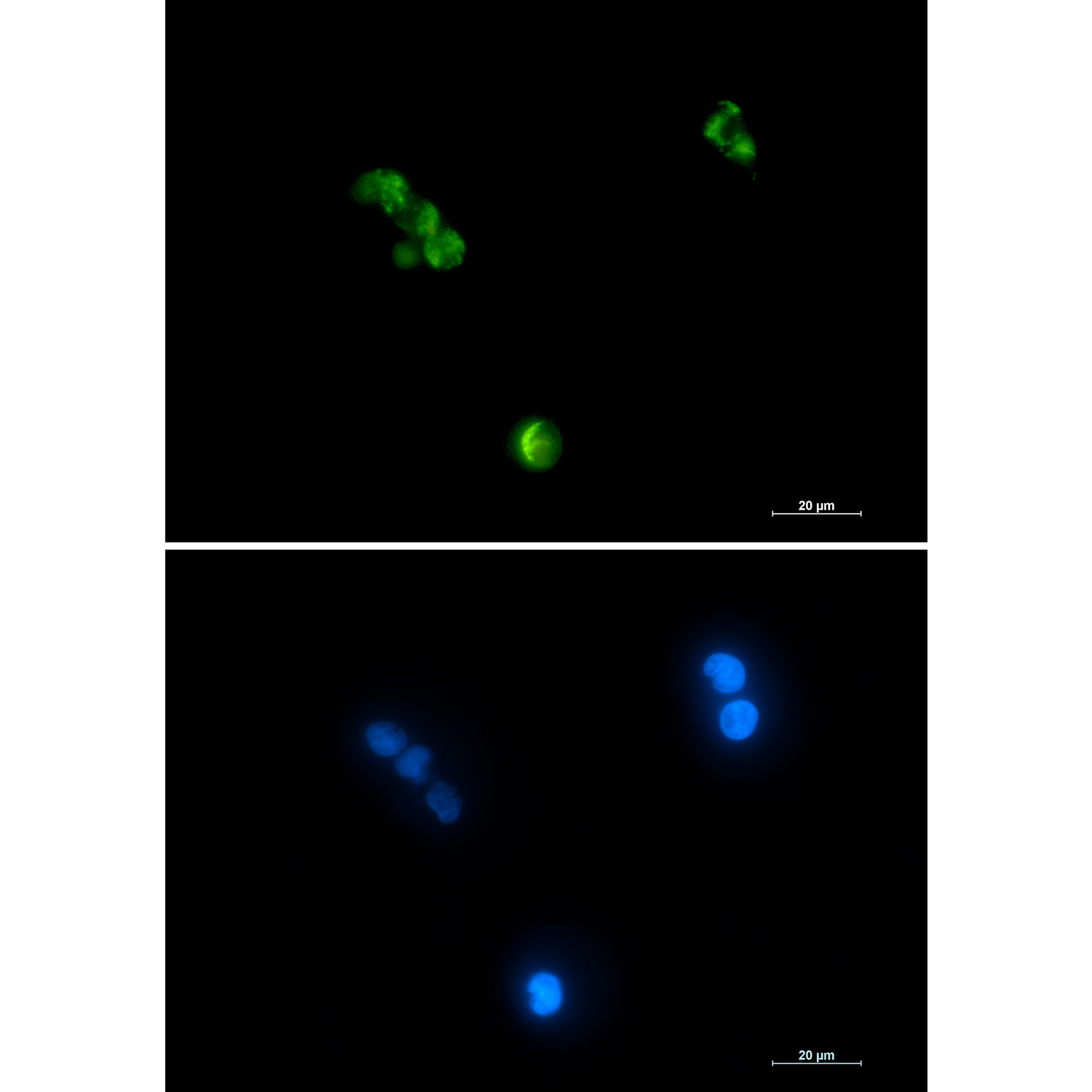 Aconitase 2 Rabbit mAb