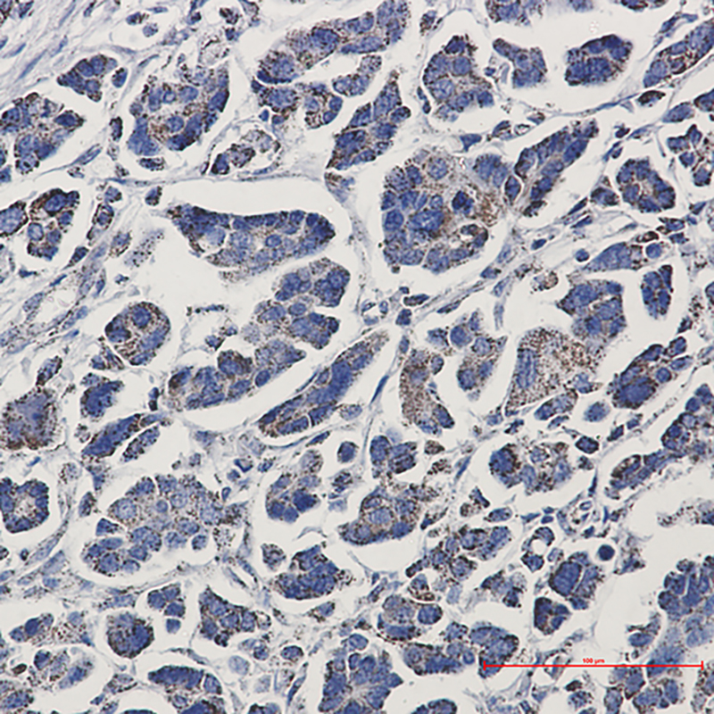 Aconitase 2 Rabbit mAb