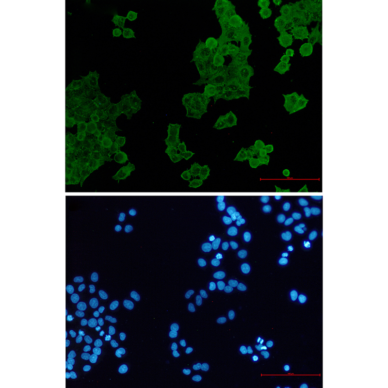 ACTR1B Rabbit mAb