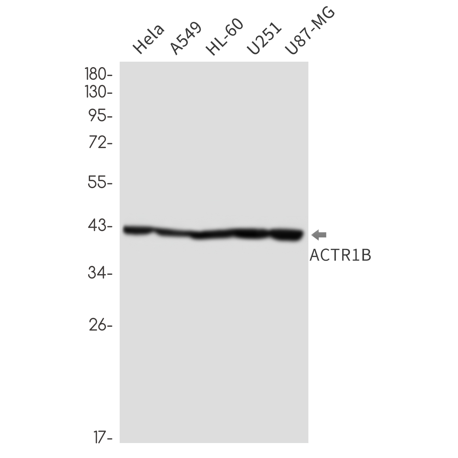 ACTR1B Rabbit mAb