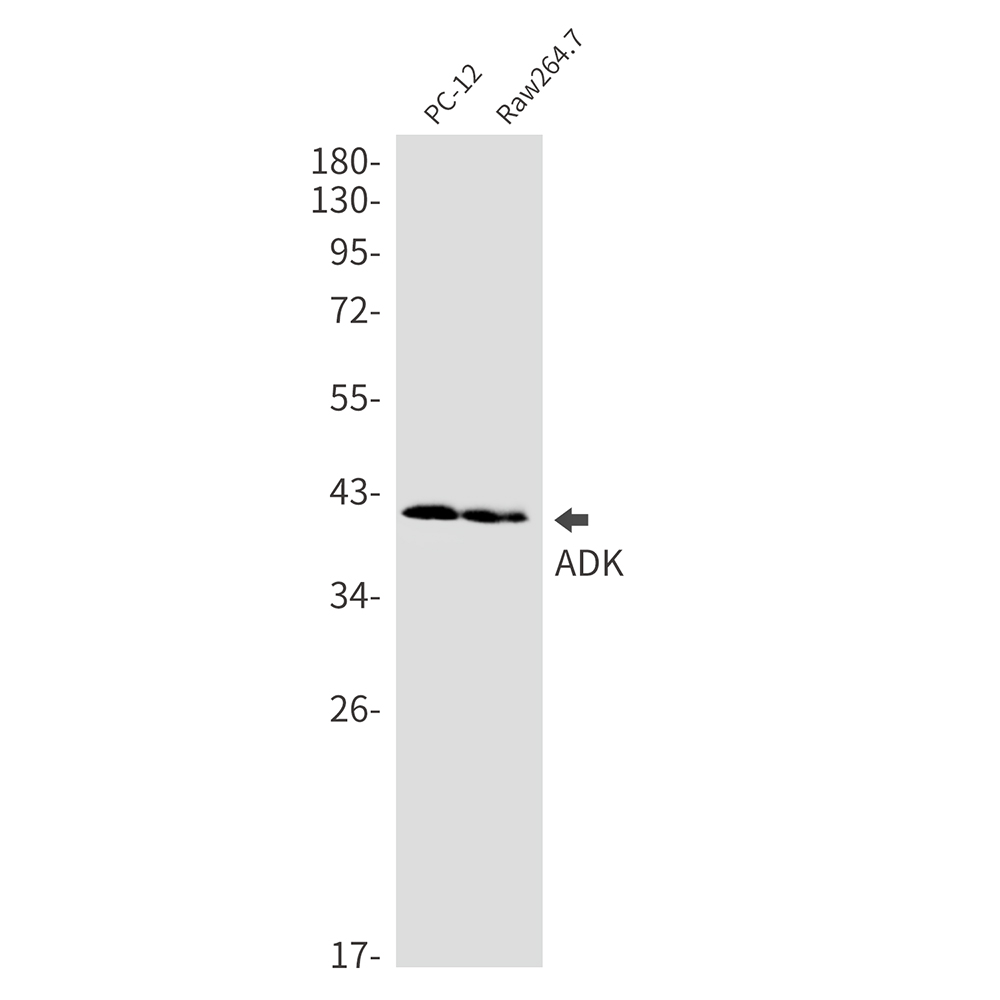 ADK Rabbit mAb