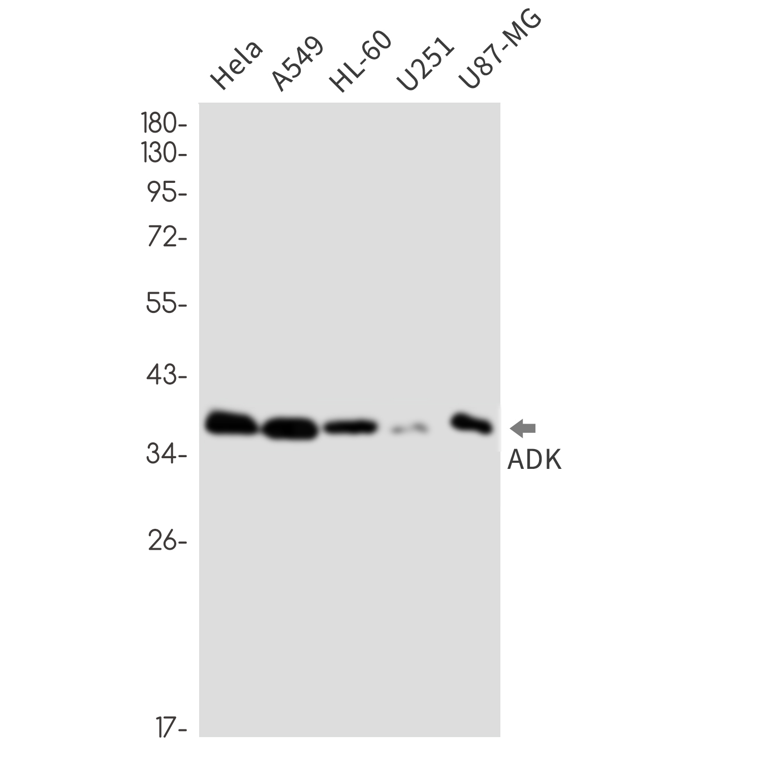 ADK Rabbit mAb