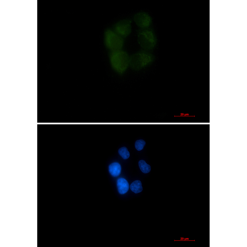 AK3L1 Rabbit mAb