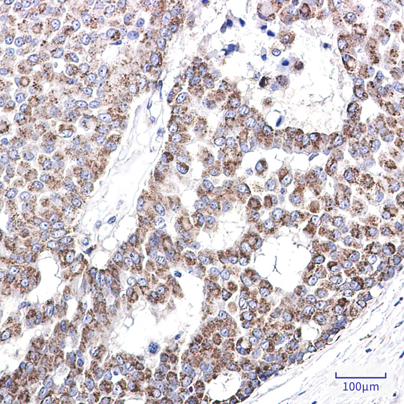 AK3L1 Rabbit mAb