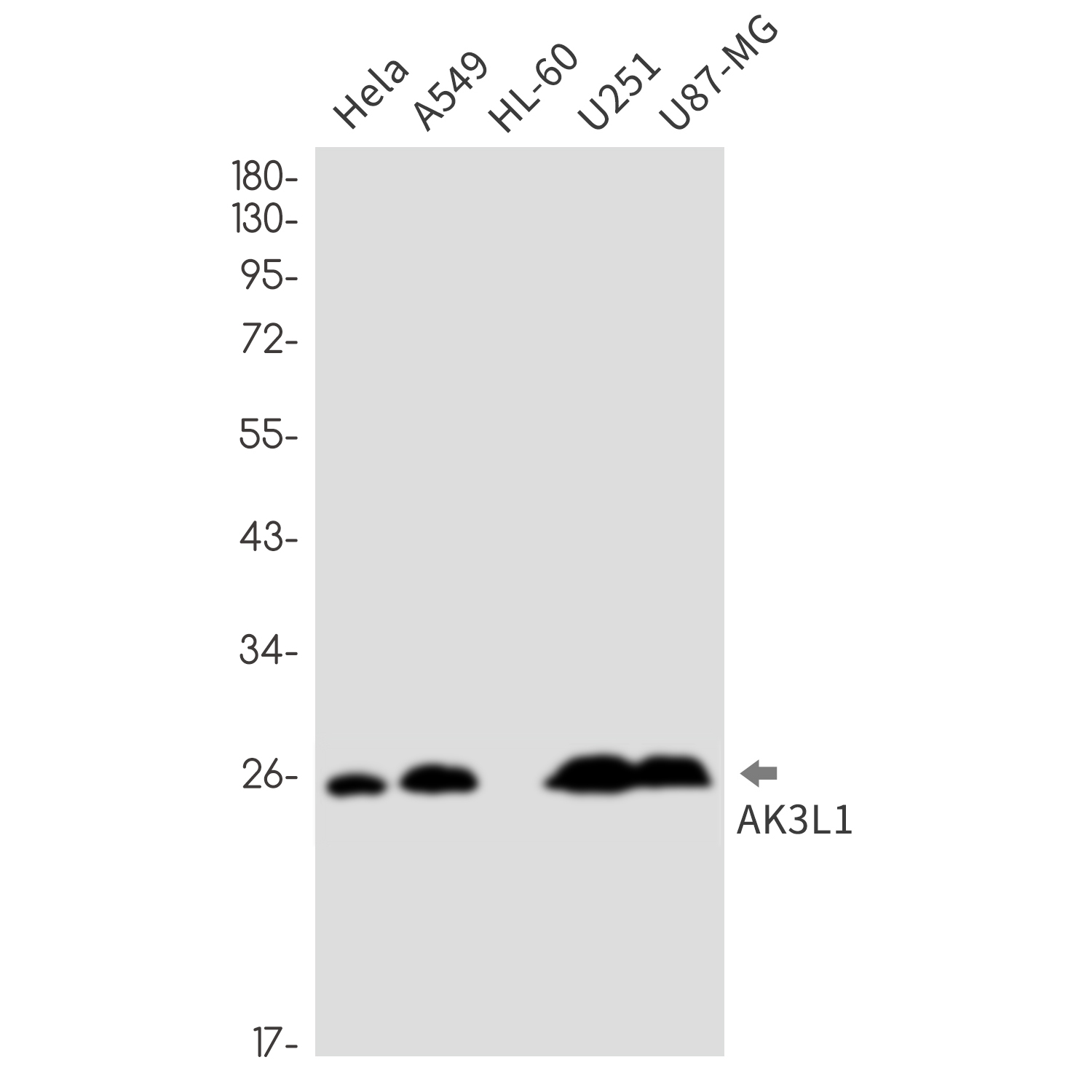 AK3L1 Rabbit mAb