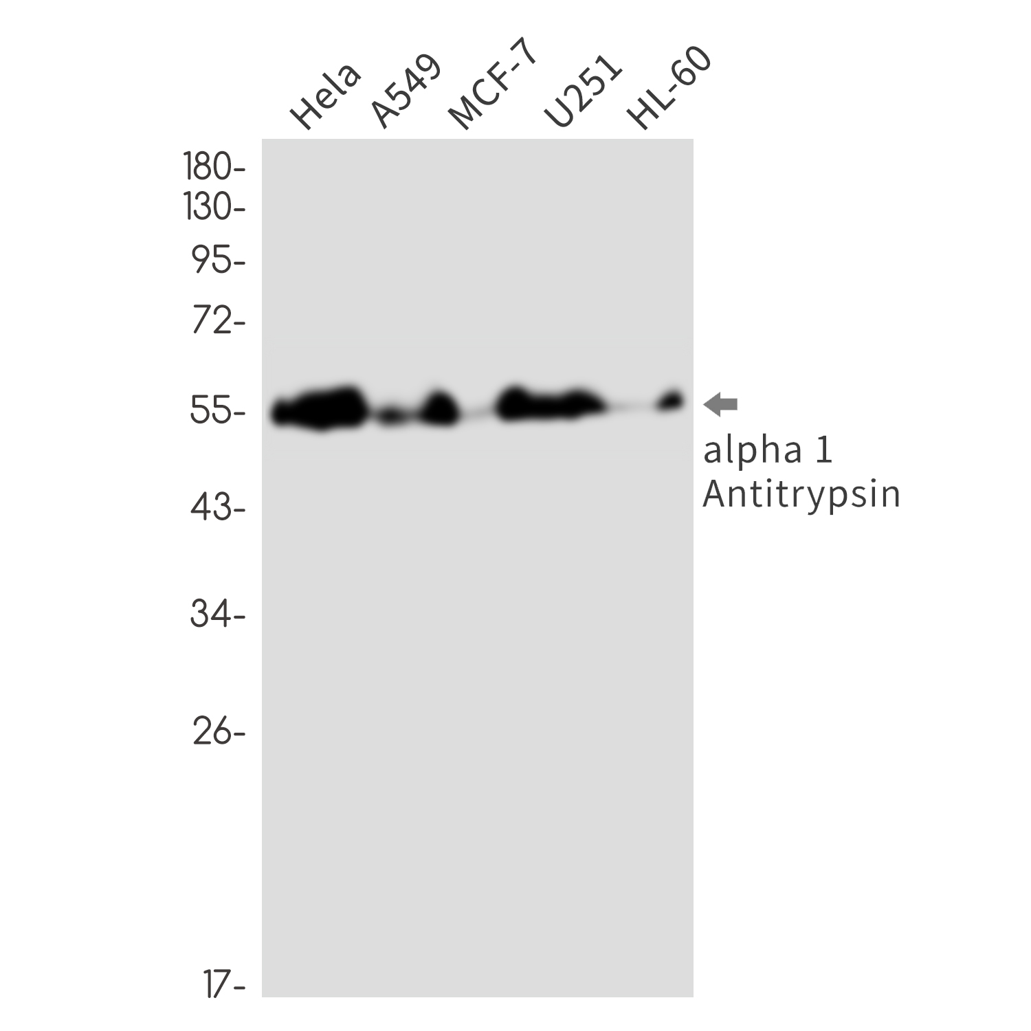 alpha 1-Antitrypsin Rabbit mAb