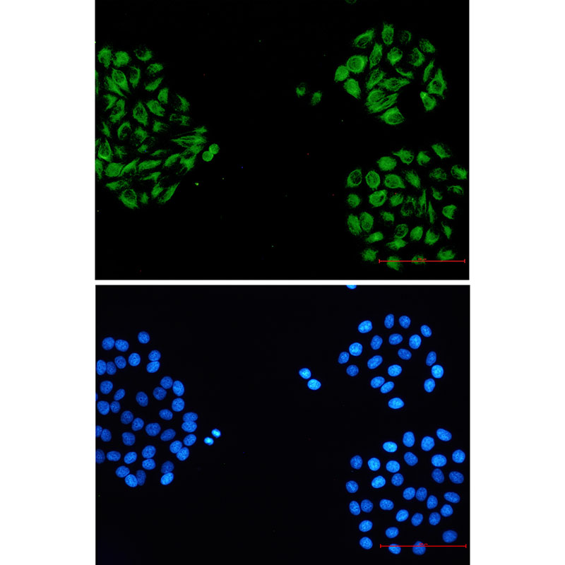 alpha Internexin Rabbit mAb