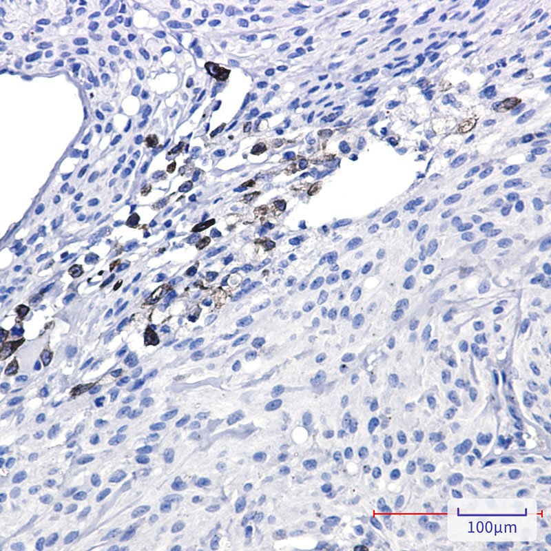 alpha Internexin Rabbit mAb