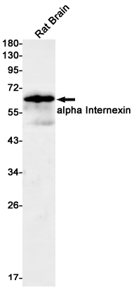 alpha Internexin Rabbit mAb