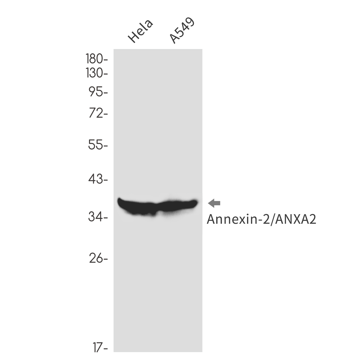 Annexin 2 Rabbit mAb