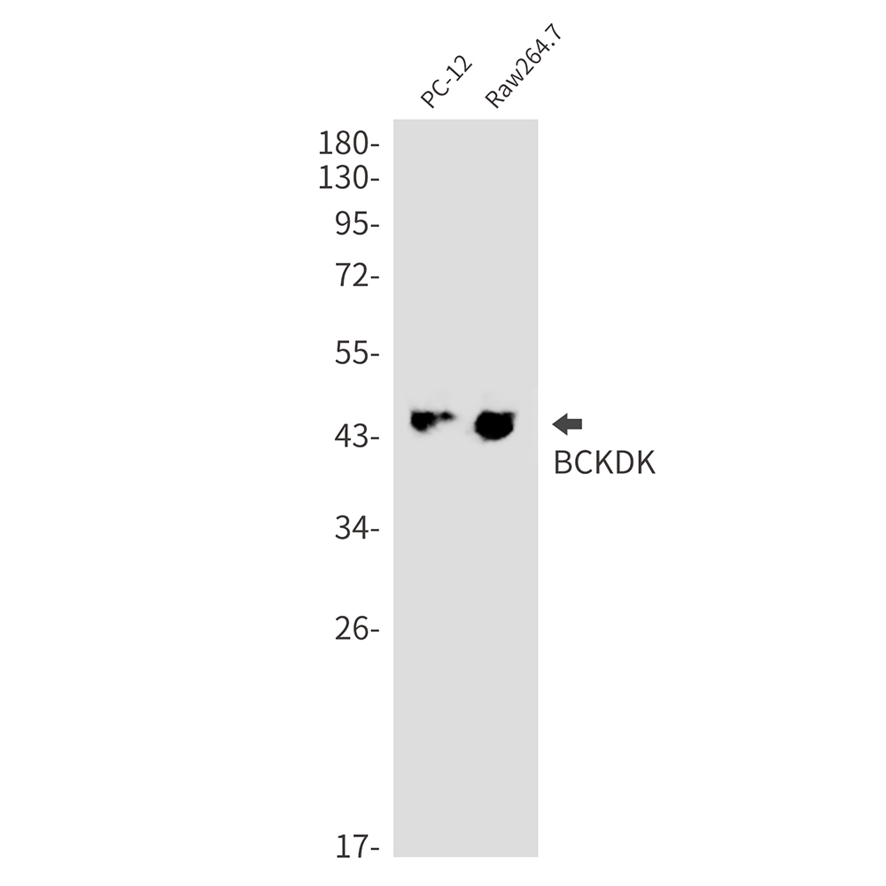 BCKDK Rabbit mAb