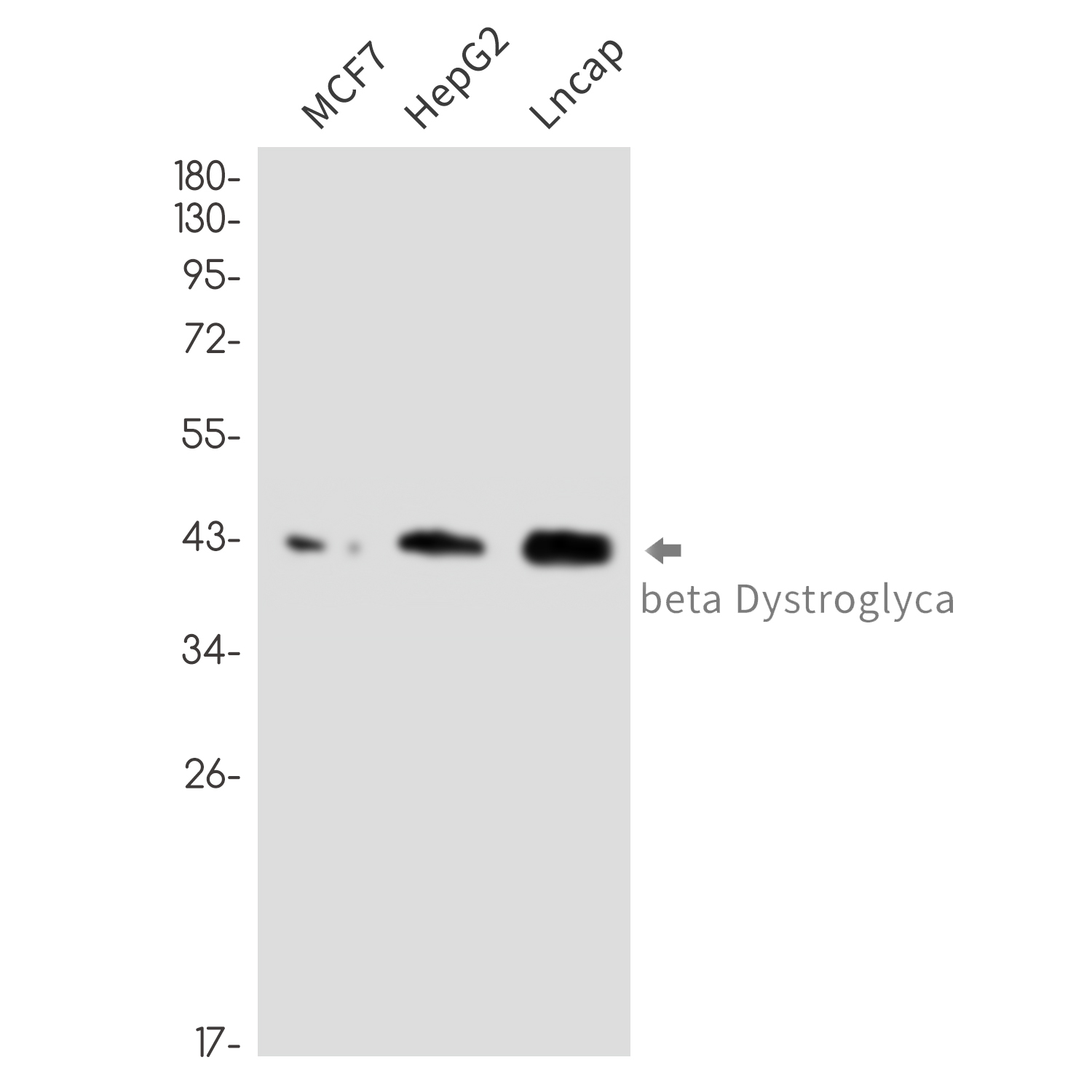 beta Dystroglycan Rabbit mAb