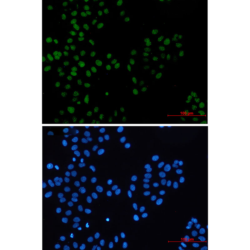 BMI1 Rabbit mAb