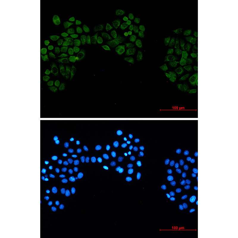 Casein Kinase 2 beta Rabbit mAb