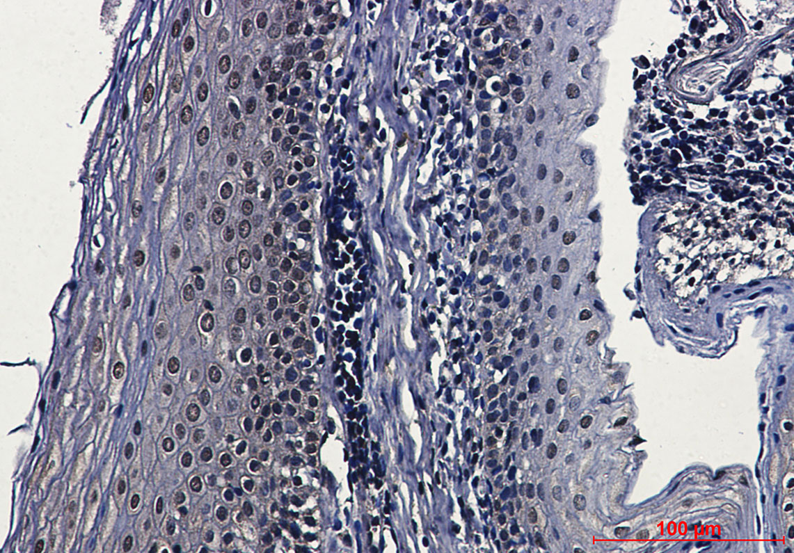 Casein Kinase 2 beta Rabbit mAb