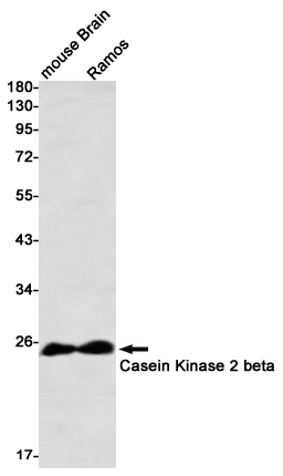 Casein Kinase 2 beta Rabbit mAb