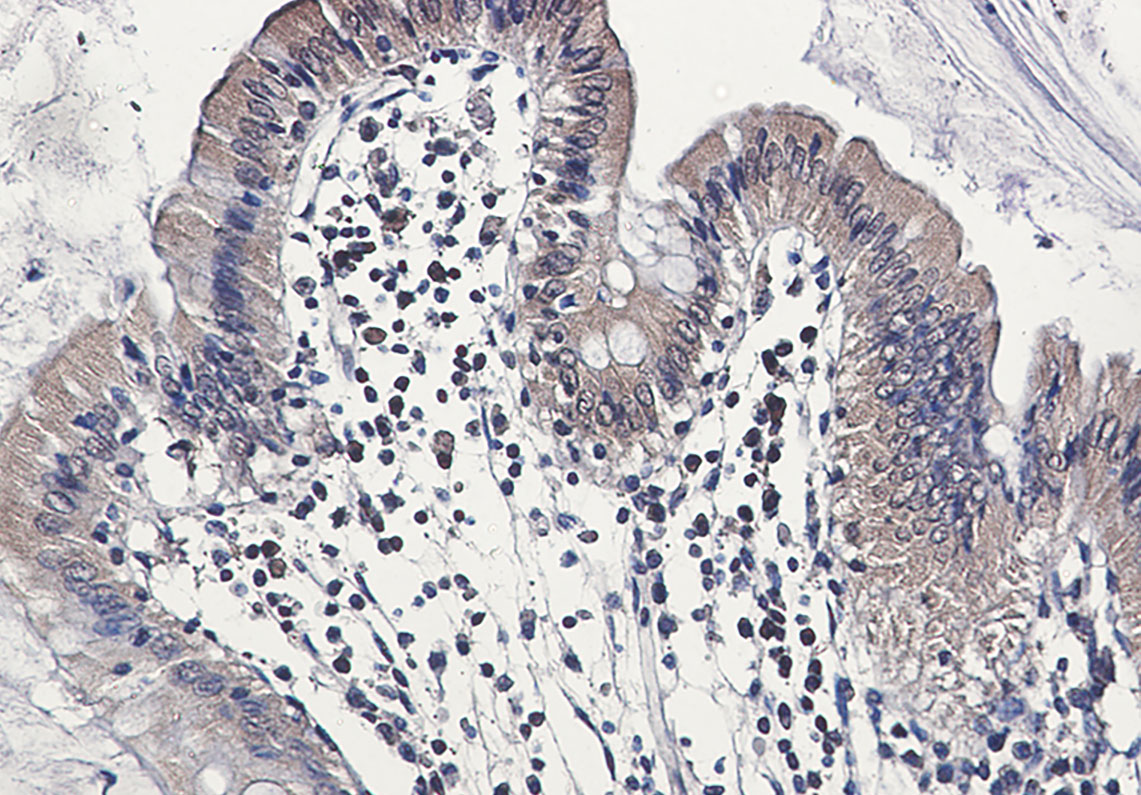 Caspase 6 Rabbit mAb