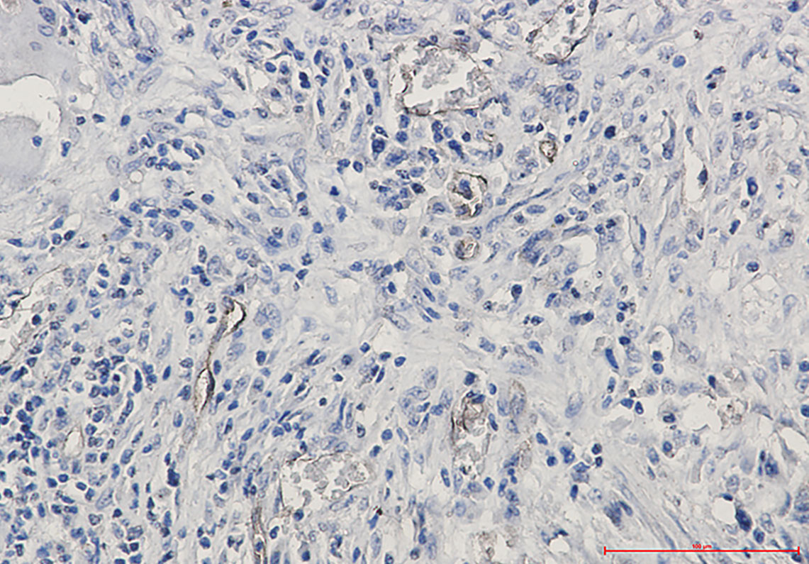 CD105 Rabbit mAb