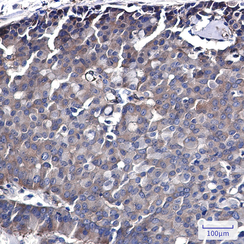 CDC37 Rabbit mAb